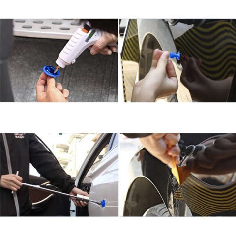 Kūno įlenkimų šalinimo rinkinys