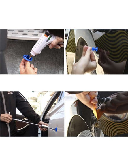 Kūno įlenkimų šalinimo rinkinys