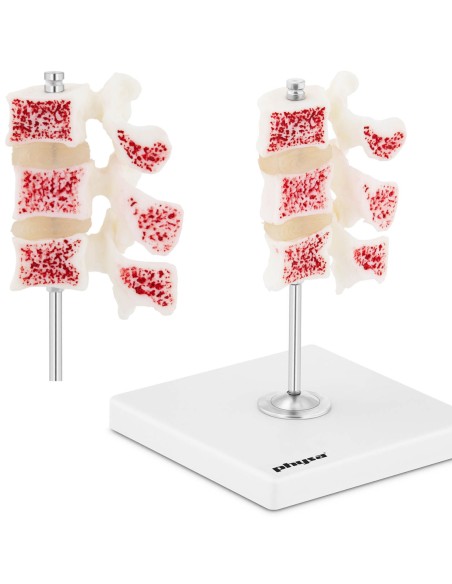 Juosmens osteoporozės slankstelių 3D anatominis modelis 3-5 Juosmens osteoporozės slankstelių 3D anatominis modelis 3-5