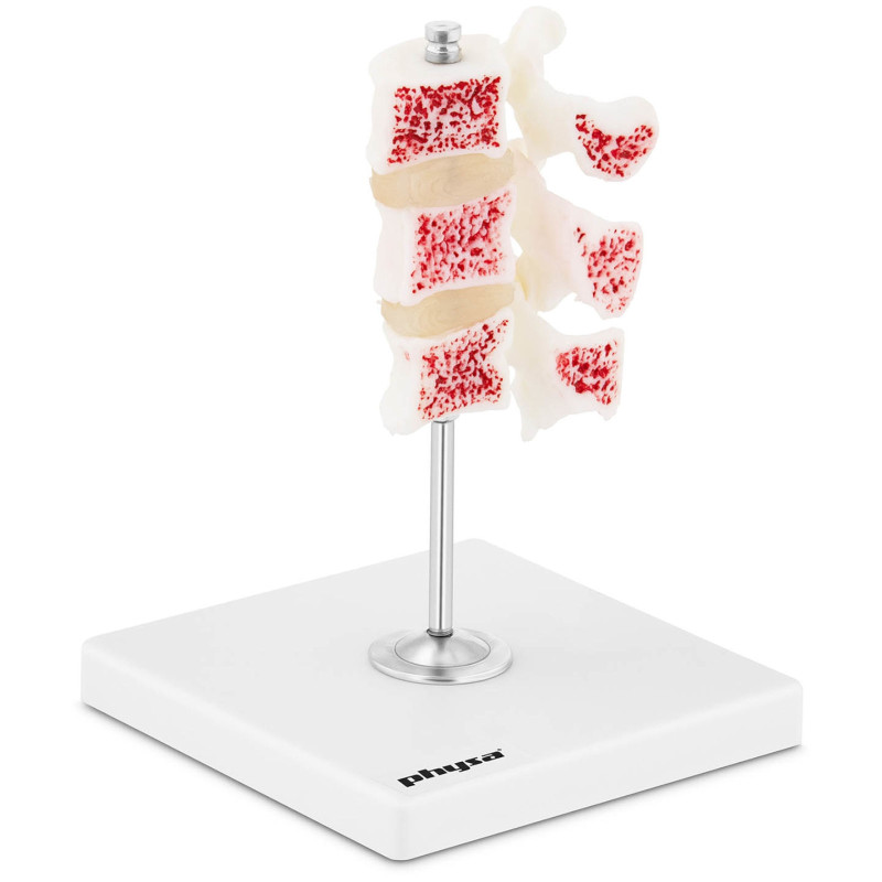 Juosmens osteoporozės slankstelių 3D anatominis modelis 3-5