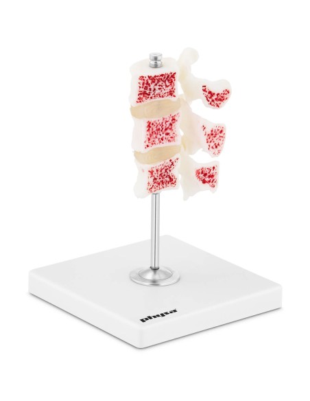 Juosmens osteoporozės slankstelių 3D anatominis modelis 3-5 Juosmens osteoporozės slankstelių 3D anatominis modelis 3-5