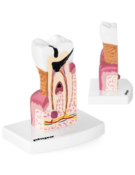 Anatominis sergančio žmogaus danties modelis 6:1 masteliu