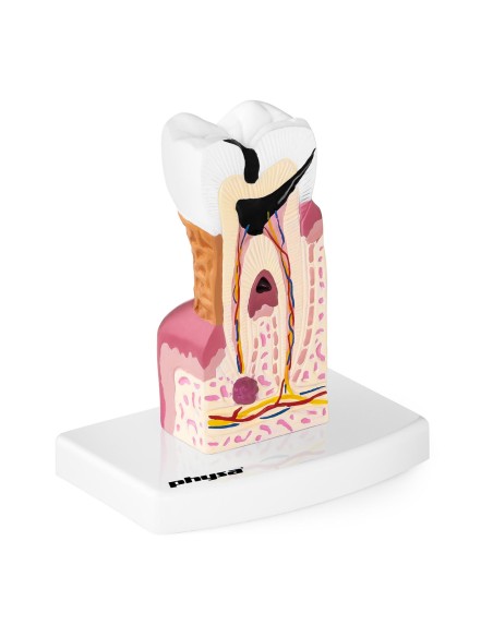 Anatominis sergančio žmogaus danties modelis 6:1 masteliu
