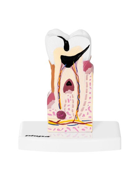 Anatominis sergančio žmogaus danties modelis 6:1 masteliu