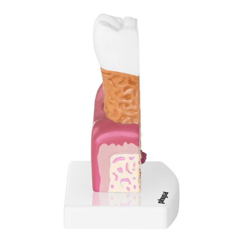 Anatominis sergančio žmogaus danties modelis 6:1 masteliu