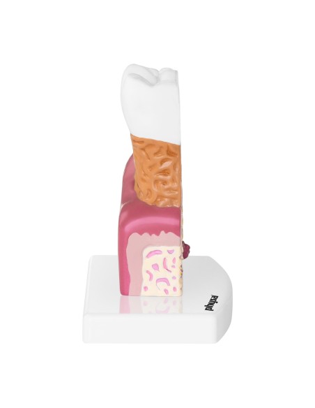 Anatominis sergančio žmogaus danties modelis 6:1 masteliu