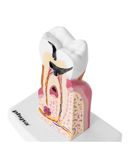 Anatominis sergančio žmogaus danties modelis 6:1 masteliu