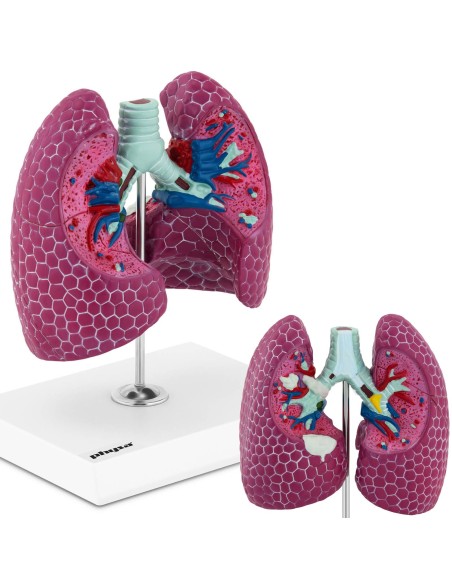 3D anatominis žmogaus plaučių modelis su pažeidimais 3D anatominis žmogaus plaučių modelis su pažeidimais